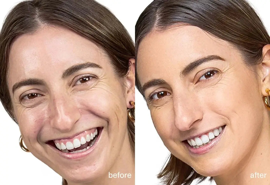 Before and After Face